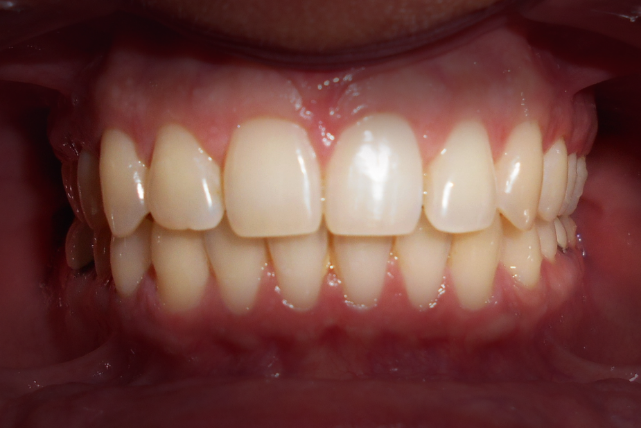 Kylie Final Frontal IO